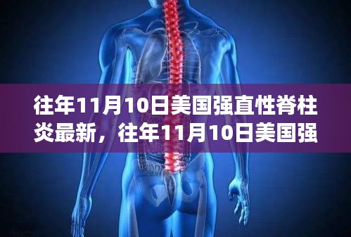 美国强直性脊柱炎最新研究进展揭秘，历年11月10日更新动态