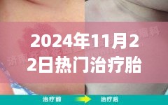 揭秘未来胎记治疗技术，革新进展与热门治疗方法的探索（2024年11月22日）