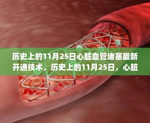 历史上的11月25日，心脏血管堵塞开通技术的里程碑事件及其最新技术突破