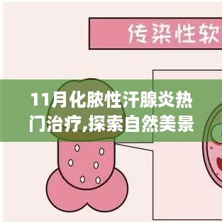 11月化脓性汗腺炎新疗法助你轻松启程自然美景之旅，探索内心宁静之道