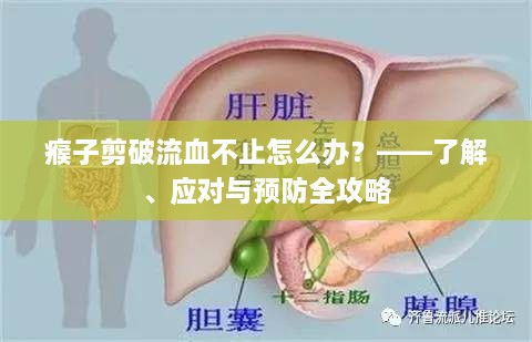 瘊子剪破流血不止怎么办？——了解、应对与预防全攻略