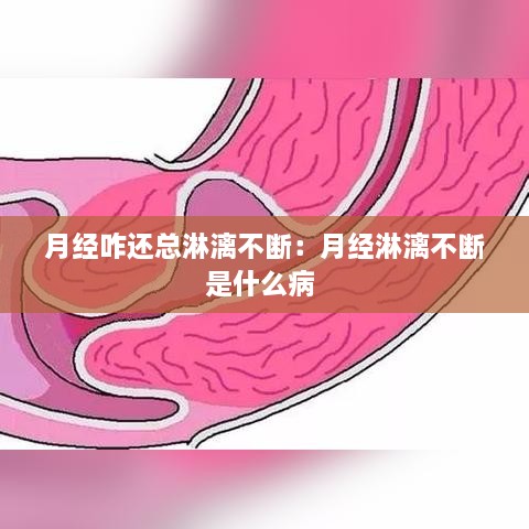 月经咋还总淋漓不断：月经淋漓不断是什么病 